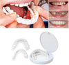 Carillas Dentales